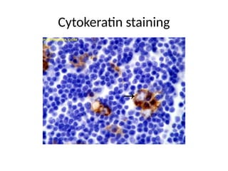 Cytokeratin staining
 