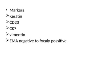 • Markers
Keratin
CD20
CK7
vimentin
EMA negative to focaly possitive.
 