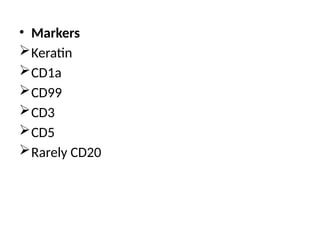• Markers
Keratin
CD1a
CD99
CD3
CD5
Rarely CD20
 
