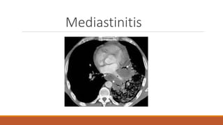 Mediastinitis
 