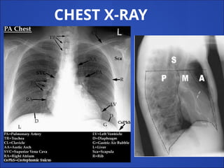CHEST X-RAY
 