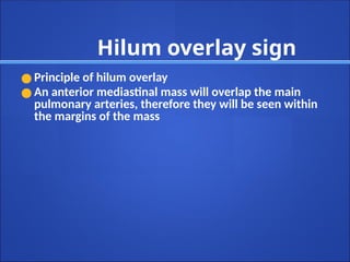 Hilum overlay sign
● Principle of hilum overlay
● An anterior mediastinal mass will overlap the main
pulmonary arteries, therefore they will be seen within
the margins of the mass
 