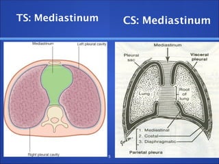 TS: Mediastinum
5
CS: Mediastinum
 