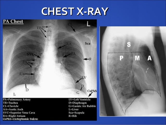 thyroid slide