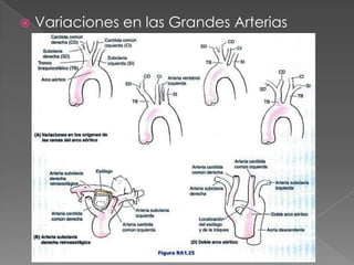    Variaciones en las Grandes Arterias
 