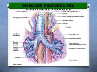 Disección profunda del
 mediastino superior
 