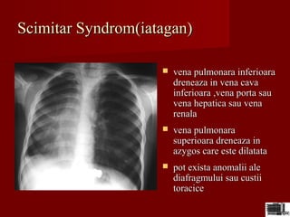  vena pulmonara inferioaravena pulmonara inferioara
dreneaza in vena cavadreneaza in vena cava
inferioara ,vena porta sauinferioara ,vena porta sau
vena hepatica sau venavena hepatica sau vena
renalarenala
 vena pulmonaravena pulmonara
superioara dreneaza insuperioara dreneaza in
azygos care este dilatataazygos care este dilatata
 pot exista anomalii alepot exista anomalii ale
diafragmului sau custiidiafragmului sau custii
toracicetoracice
Scimitar Syndrom(iatagan)Scimitar Syndrom(iatagan)
 