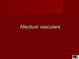 Afectiuni vasculareAfectiuni vasculare
 