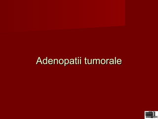 Adenopatii tumoraleAdenopatii tumorale
 