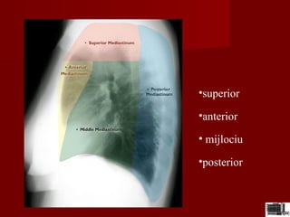 •superior
•anterior
• mijlociu
•posterior
 