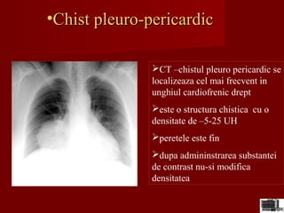 •Chist pleuro-pericardicChist pleuro-pericardic
CT –chistul pleuro pericardic se
localizeaza cel mai frecvent in
unghiul cardiofrenic drept
este o structura chistica cu o
densitate de –5-25 UH
peretele este fin
dupa admininstrarea substantei
de contrast nu-si modifica
densitatea
 