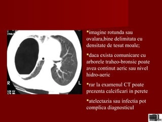 imagine rotunda sau
ovalara,bine delimitata cu
densitate de tesut moale;
daca exista comunicare cu
arborele traheo-bronsic poate
avea continut aeric sau nivel
hidro-aeric
rar la examenul CT poate
prezenta calcificari in perete
atelectazia sau infectia pot
complica diagnosticul
 