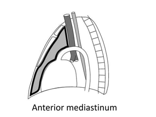 Anterior mediastinum
 