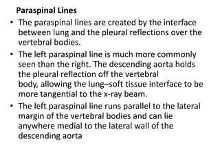 Paraspinal Lines
• The paraspinal lines are created by the interface
between lung and the pleural reflections over the
vertebral bodies.
• The left paraspinal line is much more commonly
seen than the right. The descending aorta holds
the pleural reflection off the vertebral
body, allowing the lung–soft tissue interface to be
more tangential to the x-ray beam.
• The left paraspinal line runs parallel to the lateral
margin of the vertebral bodies and can lie
anywhere medial to the lateral wall of the
descending aorta
 