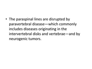 • The paraspinal lines are disrupted by
paravertebral disease—which commonly
includes diseases originating in the
intervertebral disks and vertebrae—and by
neurogenic tumors.
 
