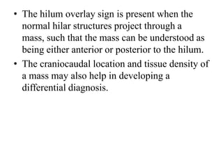 • The hilum overlay sign is present when the
normal hilar structures project through a
mass, such that the mass can be understood as
being either anterior or posterior to the hilum.
• The craniocaudal location and tissue density of
a mass may also help in developing a
differential diagnosis.
 