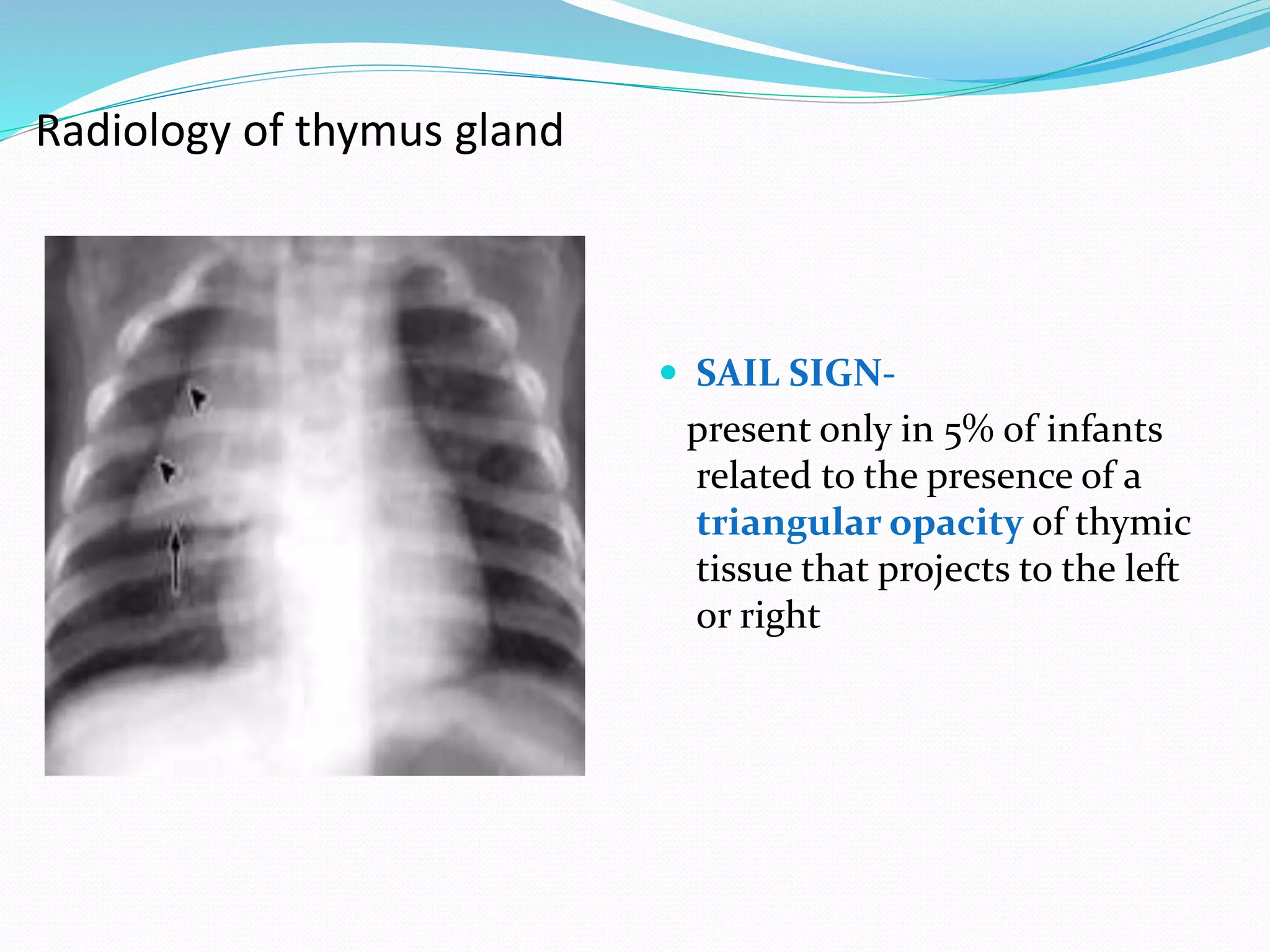 Mediastinum PPTX