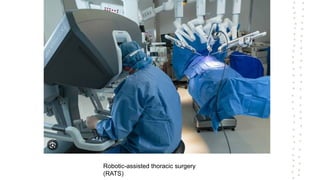 Robotic-assisted thoracic surgery
(RATS)
 