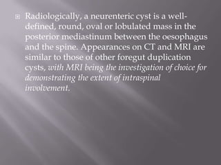  Radiologically, a neurenteric cyst is a well-
defined, round, oval or lobulated mass in the
posterior mediastinum between the oesophagus
and the spine. Appearances on CT and MRI are
similar to those of other foregut duplication
cysts, with MRI being the investigation of choice for
demonstrating the extent of intraspinal
involvement.
 
