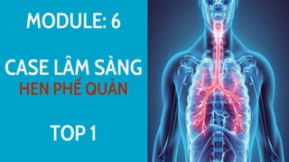MODULE: 6
CASE LÂM SÀNG
HEN PHẾ QUẢN
TOP 1
 