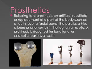Medical-Implants-and-Prosthetics.......... | PPTX