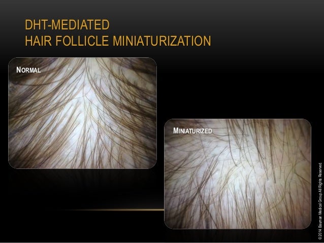 Medical Management of Hair Loss for the Integrative Medicine Practiceâ€¦