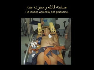 ‫جدا‬ ‫ومحزنه‬ ‫قاتله‬ ‫اصابته‬
His injuries were fatal and gruesome.
 