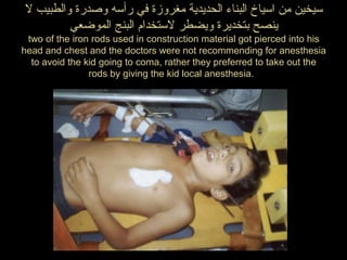 ‫ل‬ ‫والطبيب‬ ‫وصدرة‬ ‫رأعسه‬ ‫في‬ ‫مغروزة‬ ‫الحديدية‬ ‫البناء‬ ‫اعسياخ‬ ‫من‬ ‫عسيخين‬
‫الموضعي‬ ‫البنج‬ ‫لعستخدام‬ ‫ويضطر‬ ‫بتخديرة‬ ‫ينصح‬
two of the iron rods used in construction material got pierced into his
head and chest and the doctors were not recommending for anesthesia
to avoid the kid going to coma, rather they preferred to take out the
rods by giving the kid local anesthesia.
 
