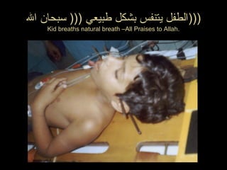 ‫ال‬ ‫سبحان‬ ))) ‫طبيعي‬ ‫بشكل‬ ‫يتنفس‬ ‫)))الطفل‬
Kid breaths natural breath –All Praises to Allah.
 