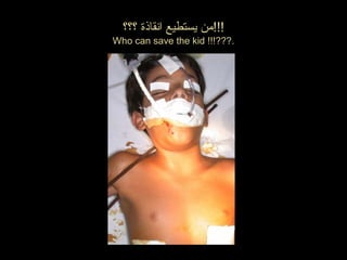 ‫؟؟؟‬ ‫انقانذة‬ ‫يستطيع‬ ‫!!!من‬
Who can save the kid !!!???.
 