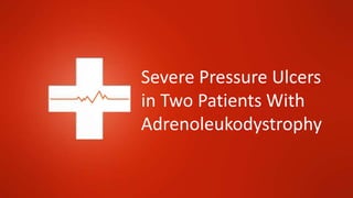 Severe Pressure Ulcers
in Two Patients With
Adrenoleukodystrophy
 