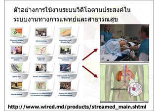 ตัวอยางการใชงานระบบวิดีโอตามประสงคใน
 ระบบงานทางการแพทยและสาธารณสุข




http://www.wired.md/products/streamed_main.shtml
 