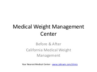 Medical Weight Management
Center
Before & After
California Medical Weight
Management
Your Nearest Medical Center - www.calmwm.com/clinics
 