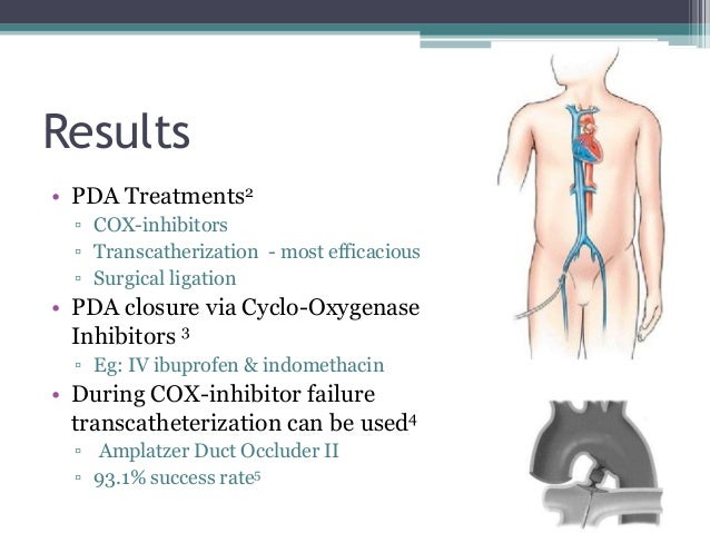 Indomethacin neonates