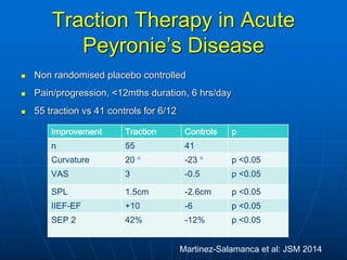 Medical and Non-surgical Treatment of Peyronie's Disease | PDF