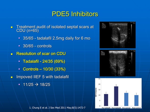 Medical and Non-surgical Treatment of Peyronie's Disease | PDF