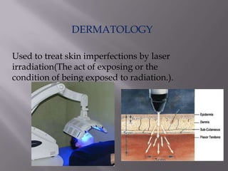 DERMATOLOGY
Used to treat skin imperfections by laser
irradiation(The act of exposing or the
condition of being exposed to radiation.).
 