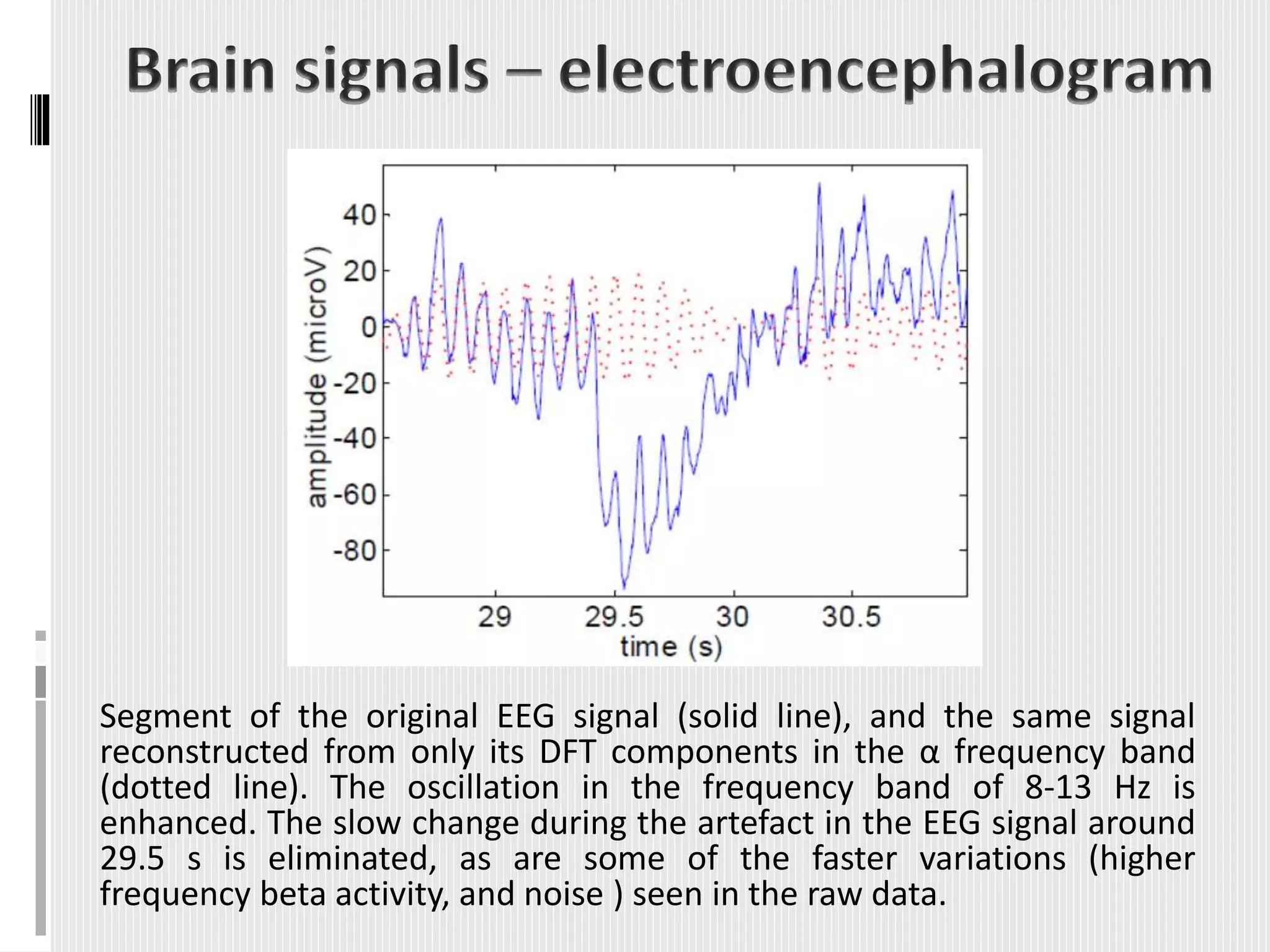 Segment of the original EEG signal (solid line), and the same signal
reconstructed from only its DFT components in the α frequency band
(dotted line). The oscillation in the frequency band of 8-13 Hz is
enhanced. The slow change during the artefact in the EEG signal around
29.5 s is eliminated, as are some of the faster variations (higher
frequency beta activity, and noise ) seen in the raw data.
 