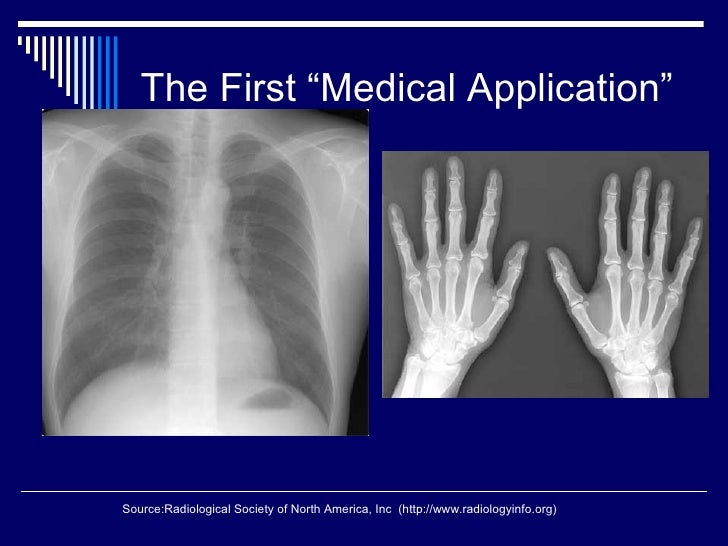 Medical applications of nuclear physics