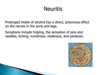 Medical aspects of addiction and co occurring disorders | PPTX