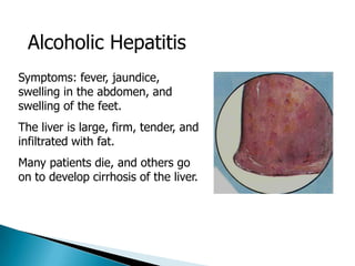 Medical aspects of addiction and co occurring disorders | PPTX