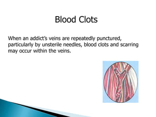 Medical aspects of addiction and co occurring disorders | PPTX