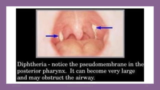 8/11/2023 Medical Bacteriology Module 2 118
 