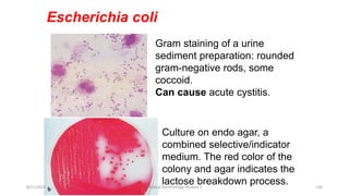 Escherichia coli
Gram staining of a urine
sediment preparation: rounded
gram-negative rods, some
coccoid.
Can cause acute cystitis.
Culture on endo agar, a
combined selective/indicator
medium. The red color of the
colony and agar indicates the
lactose breakdown process.
8/11/2023 Medical Bacteriology Module 2 138
 