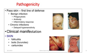 • Pass skin – first line of defense
• Benign infection
• Phagocytosis
• Antibody
• Inflammatory response
• Chronic infections
• Delayed hypersensitivity
•Clinical manifestation
• SKIN
• folliculitis
• boils (furuncles)
• carbuncles
Pathogenicity
8/11/2023 Medical Bacteriology Module 2 15
 