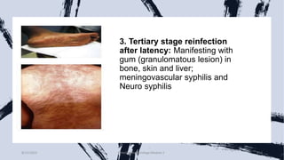 3. Tertiary stage reinfection
after latency: Manifesting with
gum (granulomatous lesion) in
bone, skin and liver;
meningovascular syphilis and
Neuro syphilis
8/11/2023 Medical Bacteriology Module 2 252
 
