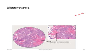 Laboratory Diagnosis
8/11/2023 Medical Bacteriology Module 2 342
 