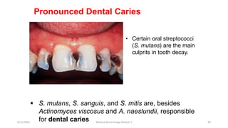 Pronounced Dental Caries
• Certain oral streptococci
(S. mutans) are the main
culprits in tooth decay.
 S. mutans, S. sanguis, and S. mitis are, besides
Actinomyces viscosus and A. naeslundii, responsible
for dental caries
8/11/2023 Medical Bacteriology Module 2 49
 