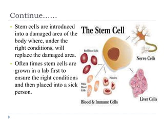 Continue……
 Stem cells are introduced
into a damaged area of the
body where, under the
right conditions, will
replace the damaged area.
 Often times stem cells are
grown in a lab first to
ensure the right conditions
and then placed into a sick
person.
 