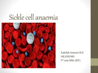 Sicklecellanaemia
Aakifah Amreen H.E
18LS301001
3rd sem MSc (BT)
 